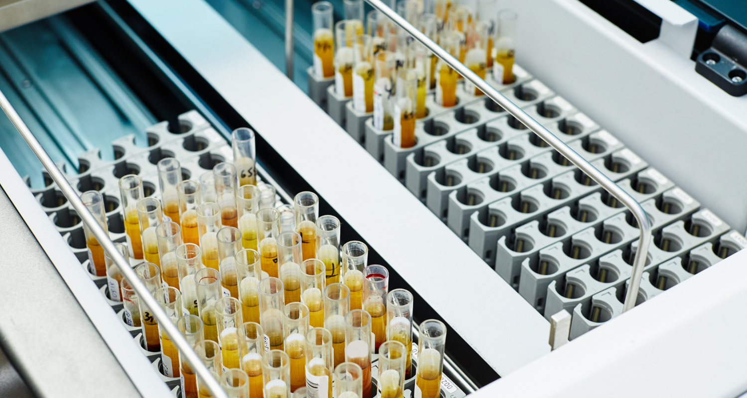 Múltiples tubos de ensayo con muestras preparadas para la medición de la Demanda Química de Oxígeno (DQO) utilizando equipos especializados en laboratorio